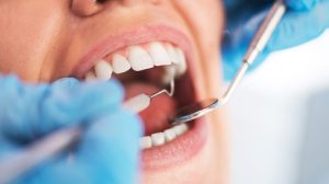 Negara Manakah Perawatan Gigi Termurah?