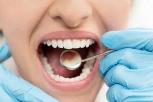Dental İmplant Ücretleri Türkiye