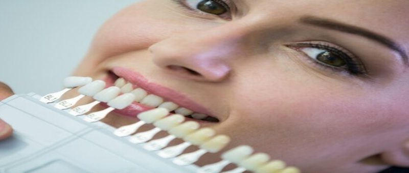 Diş Kaplama Tedavisi Türkiye
