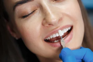 Porselen Diş Kaplama Tedavi Aşamaları