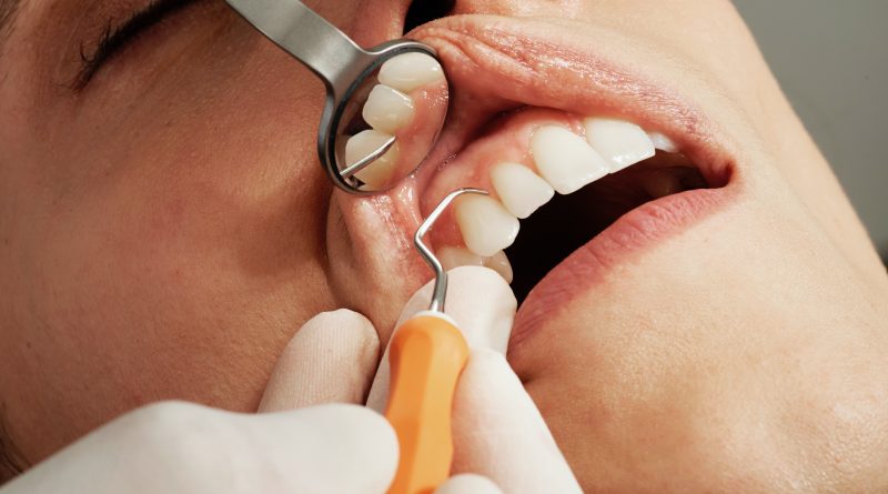 İstanbul Taksim'deki En İyi Diş Klinikleri